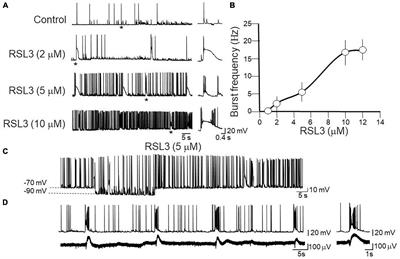 The ferroptosis inducer RSL3 triggers interictal epileptiform activity in mice cortical neurons